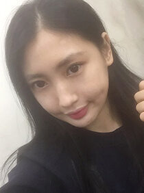 [Natural V line + cheekbone reduction] Seohyun Kim