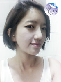 [FACEOFF+Forehead Prosthesis+T.O.P Rhinoplasty+Eye Correction] Let Me In 3 Jihye Choi