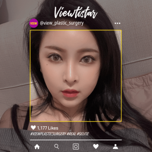 [3 types of contouring, revision eye surgery, fat grafting] Jeong Li Hyun