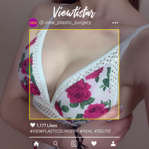 [Breast Augmentation] Na Saem