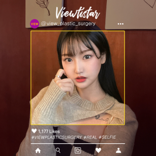 [3 Types Face Countouring + Rhinoplasty + Eye Surgery] Kim Sujeong