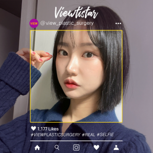 [3 Types Face Contouring, Rhinoplasty, Double Eyelid Surgery revision, Epicanthoplasty, Lateral Canthoplasty, Lateral Hotz Canthoplasty] Kim Sujeong