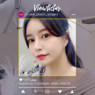 [3 Types Face Countouring + Rhinoplasty] Kim Hyunjin