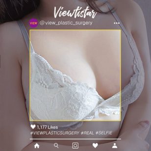 [Breast Augmentation (Motiva)] Lee Yujin