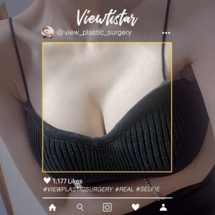 [Breast Augmentation (Motiva)] Choi Hyebin | Plastic Surgery Korea