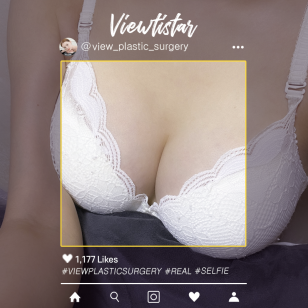 [Breast Augmentation (Motiva)] Kim Hyeji | Plastic Surgery Korea