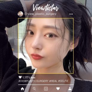 [Rhinoplasty + Under Eye Fat Reposition] Lee hyeri | Plastic Surgery Korea