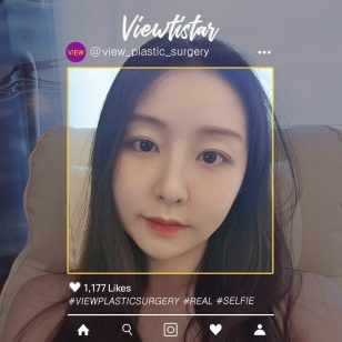 [Facial Contouring+Rhinoplasty+Double Eyelid Surgery] Lee Yujin | Plastic Surgery Korea