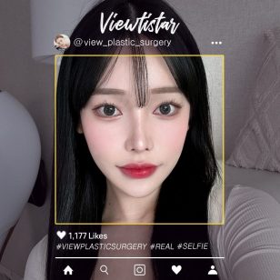 [3 Types Facial Contouring+Double Eyelid Surgery+Rhinoplasty] Koo Dohui | Plastic Surgery Korea