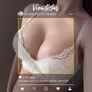 [Breast Augmentation (Motiva)] Lee Yumi | Plastic Surgery Korea