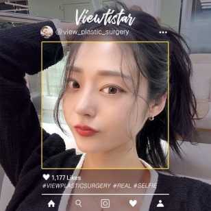 [Rhinoplasty + Under Eye Fat Reposition] Lee Hyeri | Plastic Surgery Korea