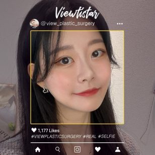 [Facial Contouring, Double Eyelid Surgery, Thread Lift] Wang Jungsuan | Plastic Surgery Korea