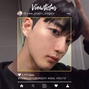 [3 Types Facial Contouring + Double Eyelid Surgery] Park Jinwon | Plastic Surgery Korea