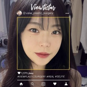 [3 Types Facial Contouring+Under Eye Fat Reposition+Fat Graft] Lee Minji | Plastic Surgery Korea