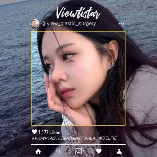 [Rhinoplasty] Lim Sohyeon | Plastic Surgery Korea