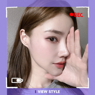 [Rhinoplasty] A heartfelt thank you to the doctor for enhancing my beauty!