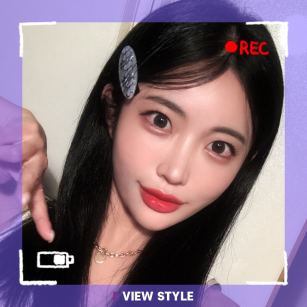 Non-incisional Double eyelid surgery Review at View Plastic Surgery