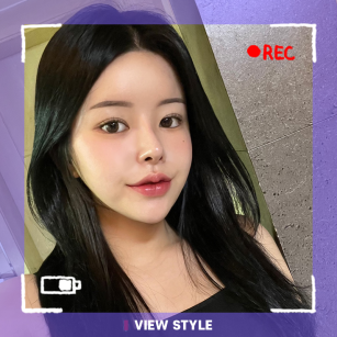 10-Month Honest Review at View Plastic Surgery in Korea